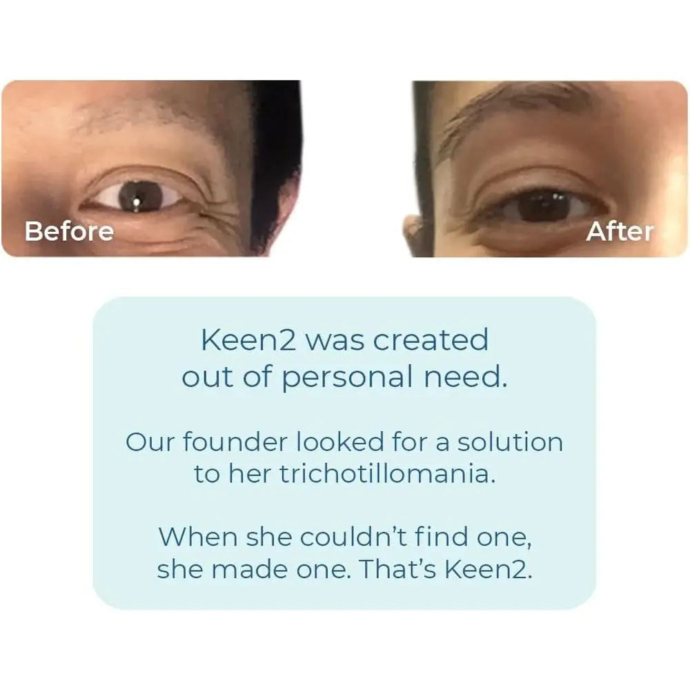 HabitAware Keen2 Bracelet – Awarenor Hair Pulling, Skin Picking & Nail Biting | Smart Habit Trainer or Trichotillomania & Dermat